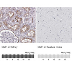 Anti-LAD1 Antibody