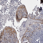 Immunohistochemical staining of human tonsil shows strong cytoplasmic positivity in squamous epithelial cells.