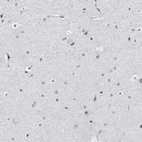 Immunohistochemical staining of human cerebral cortex shows no positivity in neurons as expected.