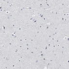 Immunohistochemical staining of human cerebral cortex shows no positivity in neurons as expected.