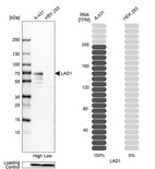 Western blot analysis in human cell lines A-431 and HEK293 using Anti-LAD1 antibody. Corresponding LAD1 RNA-seq data are presented for the same cell lines. Loading control: Anti-PFN1.