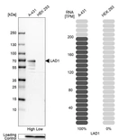 Western blot analysis in human cell lines A-431 and HEK293 using Anti-LAD1 antibody. Corresponding LAD1 RNA-seq data are presented for the same cell lines. Loading control: Anti-PFN1.