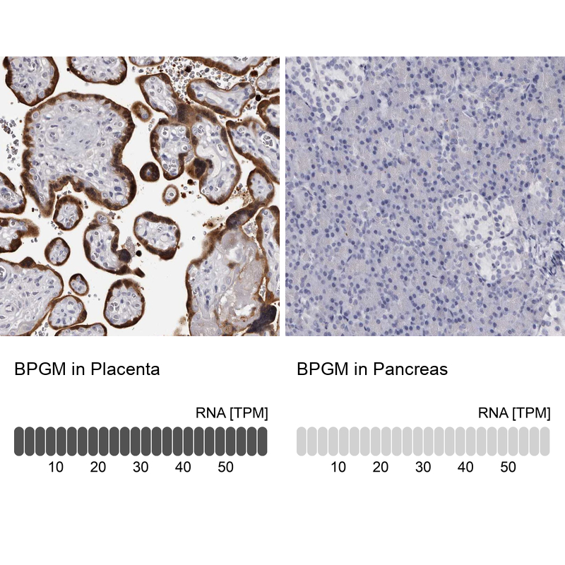 Anti-BPGM Antibody