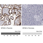 Anti-BPGM Antibody