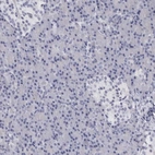 Immunohistochemical staining of human pancreas shows low expression as expected.