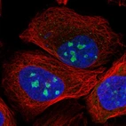 Immunofluorescent staining of human cell line U-2 OS shows localization to nucleoli.