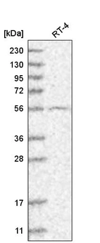 Anti-GRK4 Antibody