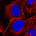 Immunofluorescent staining of human cell line U-2 OS shows localization to vesicles.