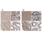 Anti-MECR Antibody