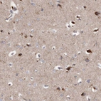 Immunohistochemical staining of human cerebral cortex shows strong cytoplasmic positivity in neurons.