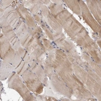 Immunohistochemical staining of human skeletal muscle shows moderate cytoplasmic positivity in myocytes.