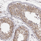 Immunohistochemical staining of human testis shows moderate cytoplasmic positivity in cells in seminiferous ducts.