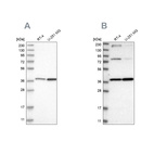 Western blot analysis using Anti-MECR antibody HPA028740 (A) shows similar pattern to independent antibody HPA022018 (B).