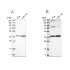 Western blot analysis using Anti-MECR antibody HPA028740 (A) shows similar pattern to independent antibody HPA022018 (B).