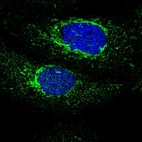Immunofluorescent staining of human cell line A-431 shows localization to mitochondria.
