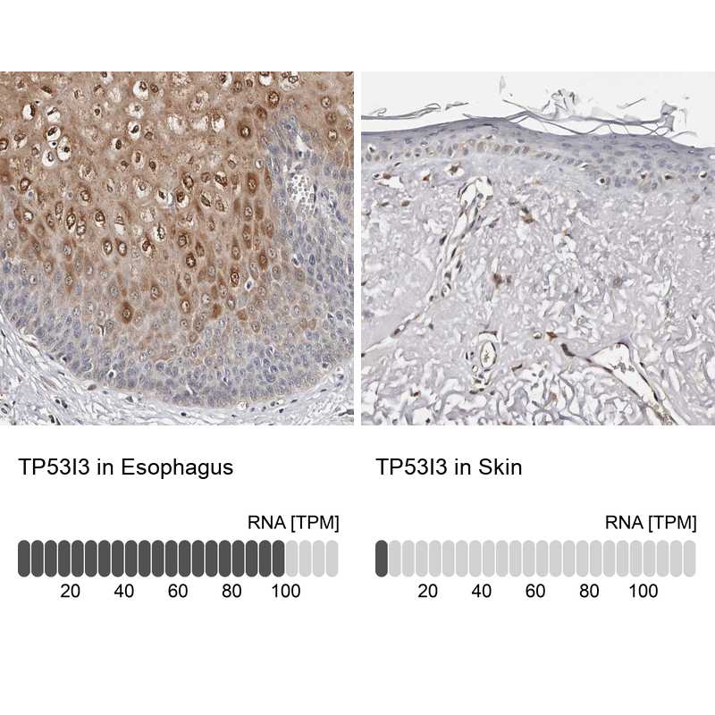 Anti-TP53I3 Antibody