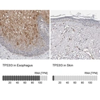 Anti-TP53I3 Antibody