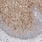 Immunohistochemical staining of human esophagus shows high expression.