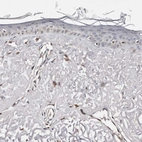 Immunohistochemical staining of human skin shows low expression as expected.