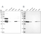 Western blot analysis using Anti-TP53I3 antibody HPA028742 (A) shows similar pattern to independent antibody HPA022012 (B).