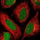 Immunofluorescent staining of human cell line SiHa shows localization to nucleus & centrosome.