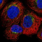 Immunofluorescent staining of human cell line A-431 shows localization to endoplasmic reticulum, endosomes & lysosomes.