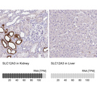 Anti-SLC12A3 Antibody