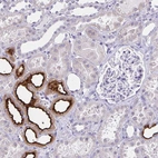 Immunohistochemical staining of human kidney shows strong membranous positivity in cells in distal tubules.