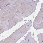 Anti-SLC12A3 Antibody