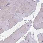 Immunohistochemical staining of human skeletal muscle shows no positivity in myocytes as expected.