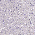 Anti-SLC12A3 Antibody