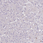 Immunohistochemical staining of human liver shows no positivity in hepatocytes as expected.