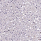 Immunohistochemical staining of human liver shows no positivity in hepatocytes as expected.