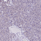 Anti-SLC12A3 Antibody
