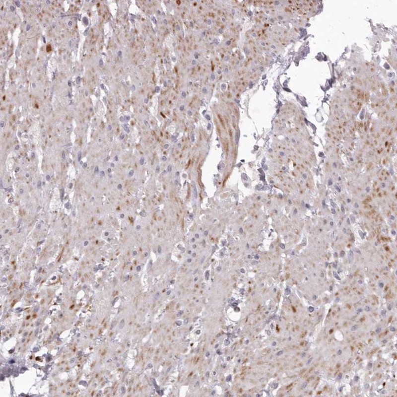 Anti-GARNL3 Antibody