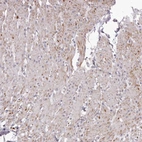 Anti-GARNL3 Antibody