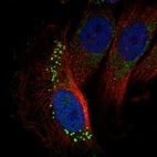Immunofluorescent staining of human cell line U-251 MG shows localization to vesicles.