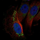 Immunofluorescent staining of human cell line U-251 MG shows localization to vesicles.