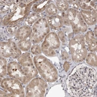 Immunohistochemical staining of human kidney shows moderate cytoplasmic positivity in cells in tubules.