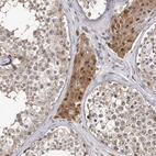 Immunohistochemical staining of human testis shows moderate cytoplasmic positivity in Leydig cells.