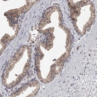 Immunohistochemical staining of human prostate shows weak cytoplasmic positivity in glandular cells.