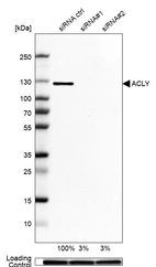 Western blot analysis in A-549 cells transfected with control siRNA, target specific siRNA probe #1 and #2, using Anti-ACLY antibody. Remaining relative intensity is presented. Loading control: Anti-GAPDH.