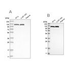 Anti-ACLY Antibody