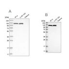 Western blot analysis using Anti-ACLY antibody HPA028758 (A) shows similar pattern to independent antibody HPA022434 (B).