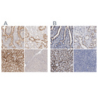 Anti-ACOX1 Antibody