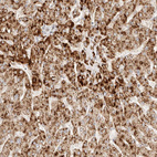 Immunohistochemical staining of human liver shows strong granular cytoplasmic positivity in hepatocytes.