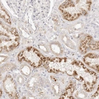 Immunohistochemical staining of human kidney shows moderate granular cytoplasmic positivity in cells in tubules.
