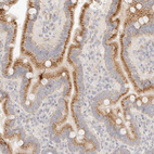 Immunohistochemical staining of human duodenum shows strong granular cytoplasmic positivity in glandular cells.