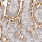 Immunohistochemical staining of human duodenum shows strong granular cytoplasmic positivity in glandular cells.