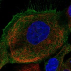 Immunofluorescent staining of human cell line A-431 shows localization to plasma membrane & cytosol.